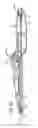 Fig. 09 - Delivery system having one piece inner member with flat distal end portion