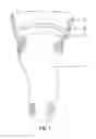Fig. 02 - Negative gauge pressure moisture management and secure adherence artificial limb system and associated methods
