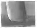 Fig. 01 - Method for etching glass or metal substrates using negative photoresist and method for fabricating cliche using the same