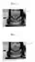 Fig. 02 - Image processing method and apparatus for reducing noise in an image