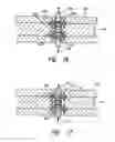Fig. 17 - Camera for mounting