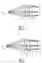Fig. 02 - Flat field eyepiece