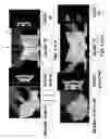 Fig. 09 - Solid state optical illumination apparatus