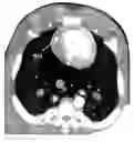 Fig. 01 - SYNCHRONIZATION OF X-RAY SOURCE POSITION DURING CARDIAC-GATED COMPUTED TOMOGRAPHY