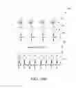 Fig. 18 - Optimized directionless optical add/drop module systems and methods