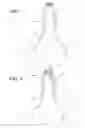 Fig. 04 - LENS HANDLER