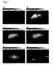 Fig. 02 - Near Infrared Imaging Agent
