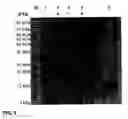 Fig. 06 - Human growth and differentiation factor GDF-5