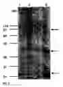Fig. 07 - Human growth and differentiation factor GDF-5