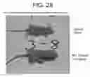 Fig. 34 - Antibodies to IL-6 and use thereof
