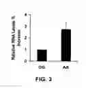 Fig. 04 - METHOD OF DETECTING OCULAR DISEASES AND PATHOLOGIC CONDITIONS AND TREATMENT OF SAME