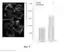 Fig. 07 - METHOD OF DETECTING OCULAR DISEASES AND PATHOLOGIC CONDITIONS AND TREATMENT OF SAME