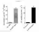 Fig. 10 - Human beta-glucuronidase mutants with elevated enzymatic activity under physiological conditions and method for identifying such