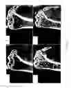 Fig. 09 - Osteopontin Specific Antibodies and Methods of Use Thereof