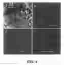 Fig. 05 - Method for preparing hydro/organo gelators from disaccharide sugars by biocatalysis and their use in enzyme-triggered drug delivery