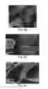 Fig. 05 - MICROTUBES AND METHODS OF PRODUCING SAME