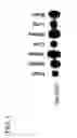 Fig. 02 - cDNA Encoding a Gene Bog (B5T Over-Expressed Gene) and its Protein Product