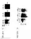 Fig. 04 - cDNA Encoding a Gene Bog (B5T Over-Expressed Gene) and its Protein Product
