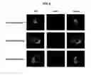 Fig. 03 - Inhibitors of Rv0256c