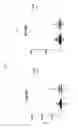 Fig. 05 - DISEASE MARKERS