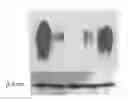 Fig. 01 - Methods of treating cancer using siRNA molecules directed against CD24