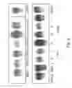 Fig. 03 - Methods of treating cancer using siRNA molecules directed against CD24
