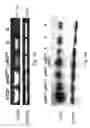 Fig. 04 - Methods of treating cancer using siRNA molecules directed against CD24