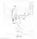 Fig. 45 - Tissue repair device