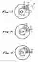 Fig. 07 - Blood sampling device