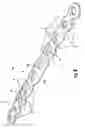 Fig. 09 - Clavicle plate and screws