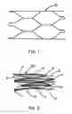 Fig. 02 - Intraluminal stent graft