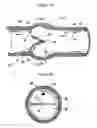 Fig. 02 - Methods of reducing retrograde flow