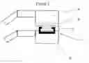 Fig. 03 - IMPLANTABLE APPARATUS FOR MODULATION OF SKELETAL GROWTH