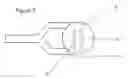 Fig. 04 - IMPLANTABLE APPARATUS FOR MODULATION OF SKELETAL GROWTH