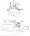 Fig. 11 - METHOD AND SYSTEM FOR PATELLA TENDON REALIGNMENT