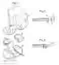 Fig. 06 - Tibial component