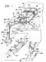 Fig. 02 - Method and apparatus to remove cast from an individual