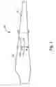 Fig. 02 - Method for assembling jointed wind turbine blade