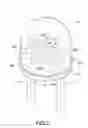 Fig. 03 - Lamp type light emitting device for safety fuse