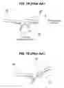 Fig. 07 - Airbag apparatus for vehicles