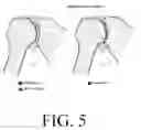 Fig. 06 - Methods, systems, and computer readable media for flexible occlusion rendering