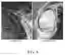 Fig. 09 - Methods, systems, and computer readable media for flexible occlusion rendering