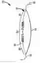 Fig. 01 - Alternating optical system: mixing and matching optics to maximize binocular visual benefits