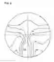 Fig. 07 - Progressive-power lens