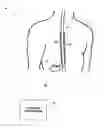 Fig. 01 - Image-based characterization of implanted medical leads