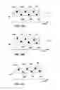 Fig. 16 - Image-based characterization of implanted medical leads