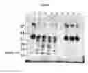 Fig. 13 - Methods and compositions for regulating iron homeostasis by modulation of BMP-6