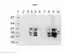 Fig. 14 - Methods and compositions for regulating iron homeostasis by modulation of BMP-6