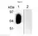 Fig. 15 - Methods and compositions for regulating iron homeostasis by modulation of BMP-6