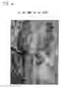 Fig. 07 - Compositions and methods for forming and strengthening bone
